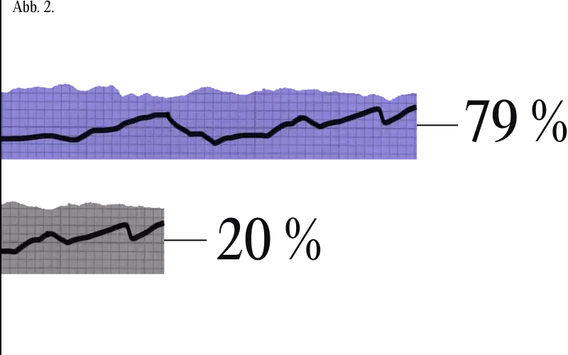 Ein Diagramm, das 79 % der in Wettbewerbsleistung führenden 20 % darstellt